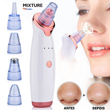 Carregar imagem no visualizador da galeria, Microderm - Removedor De Cravos